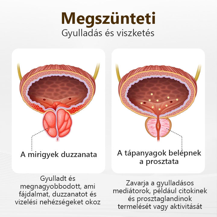 BSWELL® ProstaVibe Méh Egészség Inhalátor